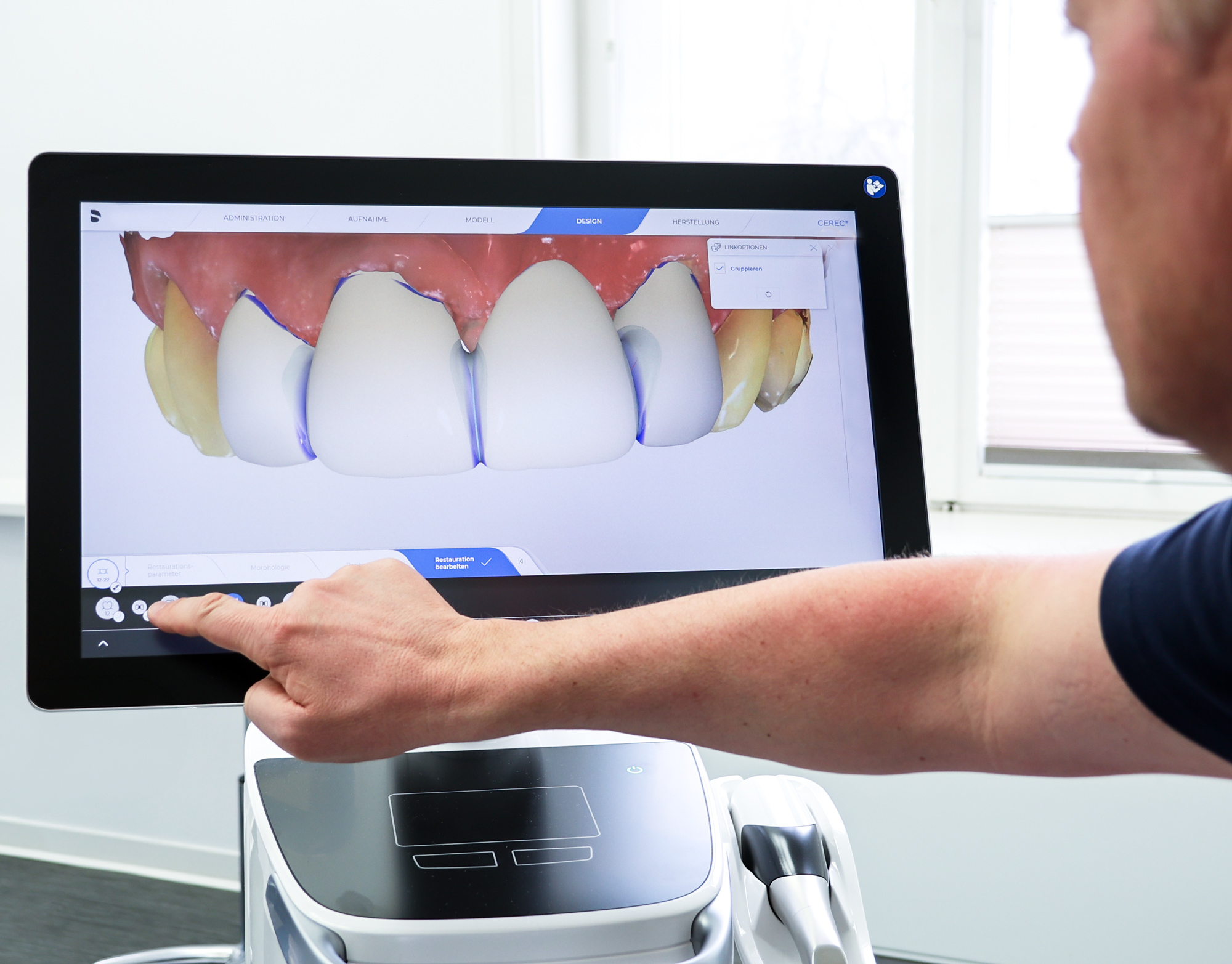 CEREC SYSTEM